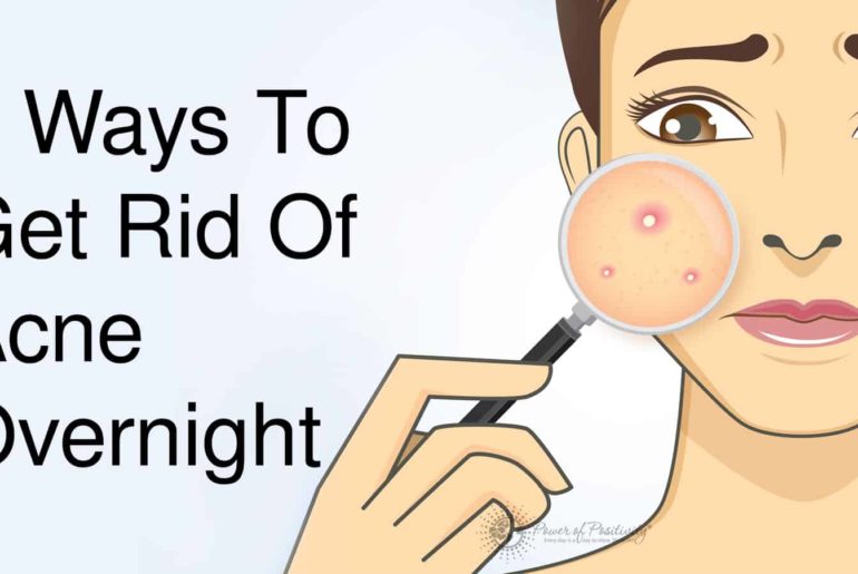 top 5 methods to remove pimples